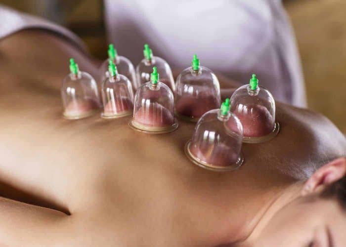 cupping-therapy-mountain-top-pa-maureen-kaminski